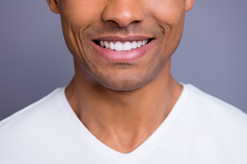 close up of patient's nice smile after veneers