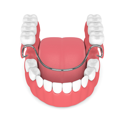 Animated image of removable dentures to show patients at Roy C. Blake III, DDS, MSD, Maxillofacial Prosthodontist in nearby Jupiter Florida exactly what these dentures look like.