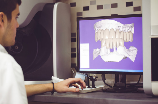 Man sitting at desk looking at a digital dental impression from Roy C. Blake III, DDS, MSD, Maxillofacial Prosthodontist in Jupiter, FL